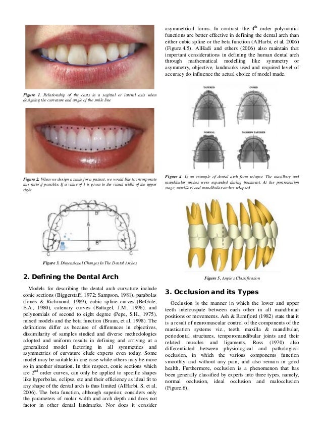 dental arch