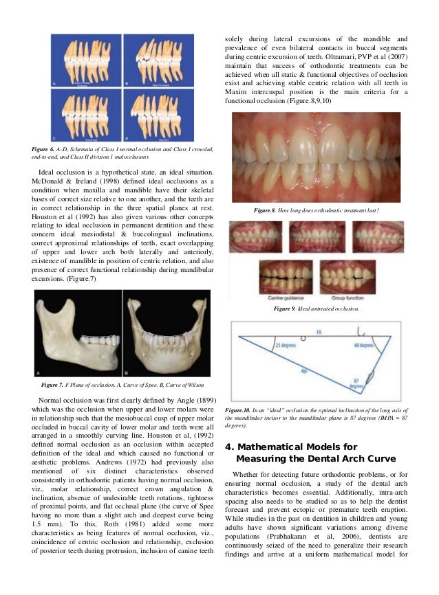The curve of dental arch in normal occlusion