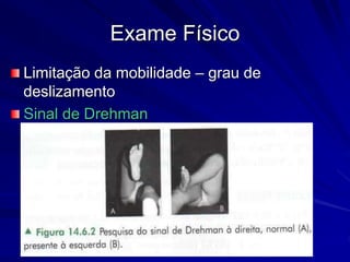 Exame Físico
Limitação da mobilidade – grau de
deslizamento
Sinal de Drehman
 