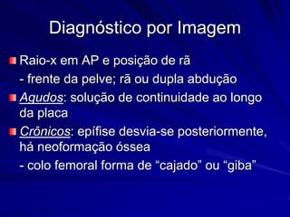 Diagnóstico por Imagem
Raio-x em AP e posição de rã
- frente da pelve; rã ou dupla abdução
Agudos: solução de continuidade ao longo
da placa
Crônicos: epífise desvia-se posteriormente,
há neoformação óssea
- colo femoral forma de “cajado” ou “giba”
 