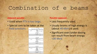 Combination of e beams
Adjacent parallel
• Used when PTV is too large.
• Special care to be taken at the
field junctions.
Parallel opposed
• Less frequently used.
• Usualy beams of high energy is
(about 40 MeV) is used.
• Significant over/under dosing
can result from beam energy
<30 MeV.
 