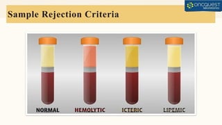 Sample Acceptance-Rejection-Criteria in lab | PPTX