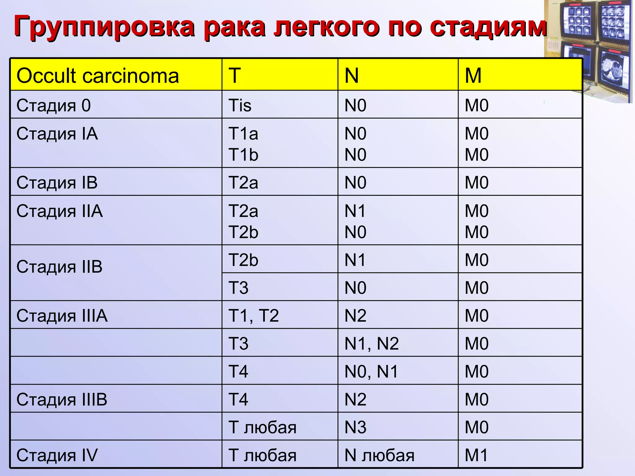 Группировка рака легкого по  c тадиям Occult carcinoma T N M Стадия 0 Tis N0 M0 Стадия  I А T1 a  T1 b N0 N0 M0 M0 Стадия  I В T2 a N0 M0 Стадия  II А T2а Т2 b N1 N0 M0 M0 Стадия  II В Т2 b N1 M0 T3 N0 M0 Стадия  III А T1 , T2 N2 M0 T 3 N1 ,  N2 M0 T 4 N0 ,  N1 M0 Стадия  III В T4 N 2 M0 T   любая N3 M0 Стадия  I V T   любая N любая M1 