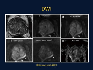 DWI
(Bittencourt et al., 2014)
 