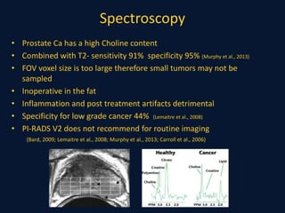 Spectroscopy
• Prostate Ca has a high Choline content
• Combined with T2- sensitivity 91% specificity 95% (Murphy et al., 2013)
• FOV voxel size is too large therefore small tumors may not be
sampled
• Inoperative in the fat
• Inflammation and post treatment artifacts detrimental
• Specificity for low grade cancer 44% (Lemaitre et al., 2008)
• PI-RADS V2 does not recommend for routine imaging
(Bard, 2009; Lemaitre et al., 2008; Murphy et al., 2013; Carroll et al., 2006)
 