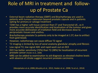 Role of MRI in treatment and follow-
up of Prostate Ca
• External beam radiation therapy (EBRT) and Brachytherapy are used in
patients with tumour extension beyond prostatic capsule and in patients
opting for primary or salvage treatment
• T2WI has a higher soft tissue contrast than CT and Transrectal US , as it
provides more accurate identification and localisation of the tumour and gives
more accurate delineation of irradiation field and decreases dose to
periprostatic tissues and urethra.
• Brachytherapy prostate Ca patients only to be imaged at 1.5T, due to artifact
from gold beads
• However, radiotherapy can cause diffuse T2 signal
• T2 imaging is limited by loss of zonal anatomy glandular atrophy and fibrosis
• Low signal T2, low signal ADC and rapid wash out on DCE
• DCE has better sensitivity (72%) than T2 (38%) for localisation of recurrent
prostate cancer (Haider et al., 2008)
• MRS can be added to examination to aid diagnosis as elevated choline levels
with absence of citrate suggest recurrent prostate carcinoma
(Westphalen et al.,2008,;Murphy et al., 2013, Haider et al., 2008; Yu et al., 2014)
 