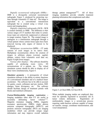 Digitally reconstructed radiographs (DRRs) -
DRR is a divergently corrected reconstructed
radiograph, Figure 3, produced by projecting ray-
lines through volumetric CT data set2
. The image is
equivalent to a conventional transmission
radiograph but is created using a virtual x-ray
source and imaging plane.
Digitally composited radiographs (DCR) - DCR
is created similarly to DRR. The difference is that
various ranges of CT numbers that relate to certain
tissue types are selectively suppressed or enhanced
in image creation, Figure 3b. The created image is
analogous to a transmission radiograph through a
virtual patient whose certain tissue types have been
removed leaving only organs of interest to be
displayed.
Multiplanar reconstruction (MPR) - CT study
consists of axial images in its native form.
Multiplanar reconstruction allows for creation of
images in arbitrary planes (coronal, sagittal,
oblique, vertex) from volumetric axial data set,
Figure 4 (right lower image).
Various other displays - The software should be
capable of producing room views, 3D
reconstructions of a patient, etc. The virtual
simulation system should be able to display all of
these views simultaneously, Figure 4.
Simulator geometry - A prerequisite of virtual
simulation software is the ability to mimic functions
of a conventional simulator and of a medical linear
accelerator. The software has to be able to account
for gantry, couch, collimator and jaw motion, SSD
changes, beam divergence, etc. The software
should facilitate design of treatment portals with
blocks and multileaf collimators.
Fusion/Multimodality imaging registration -
Imaging modalities other than CT are useful in
accurately delineating tumor volumes21-23
.
Magnetic resonance imaging (MRI), magnetic
resonance spectroscopy (MRS), single photon
emission computed tomography (SPECT), and
positron emission tomography (PET) are imaging
modalities which can provide unique target
information and may improve overall radiation
therapy patient management24-26
. All of these
imaging modalities provide valuable treatment
planning information that complement each other.
a)
b)
Figure 3. a) Chest DRR, b) Chest DCR.
When multiple imaging studies are employed, they
must be spatially registered to accurately aid in
tumor volume delineation. Registration of
multimodality images is a several-step process
requiring multi-function software capable of image
set transfer, storage, coordinate transformation, and
voxel interpolation.
 