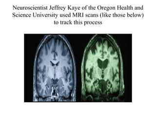 Neuroscientist Jeffrey Kaye of the Oregon Health and
Science University used MRI scans (like those below)
to track this process
 