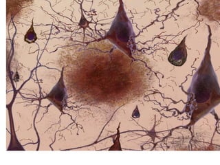 Aging Brain Talk Updated  2016