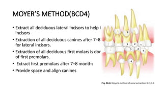 720936236-serial-extractions_for_dental_students.pptx