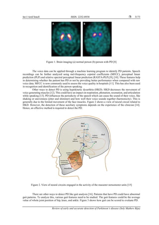 Review of early and accurate detection of Parkinson’s disease | PDF
