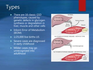 Types
 There are 16 classic GSD
phenotypes, caused by
genetic defects in glycogen
synthesis or degradation in
liver, muscle and other cells
 Inborn Error of Metabolism
(IEOM)
 1/25,000 live births US
 Severe cases are diagnosed
in early childhood
 Milder cases may go
unrecognized into
adulthood
 