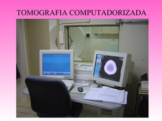 TOMOGRAFIA COMPUTADORIZADA
 