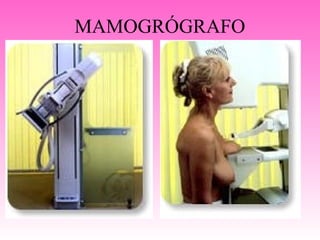 MAMOGRÓGRAFO
 