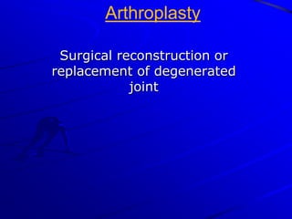 Extracapsular typesIntertrochanteric- passes between                                   two trochanterspertrochanteric –passes through the                          two trochanters,one                        or both of which may                        be seperatedSubtrochanteric -2or3 inches below                              lesser trochanter