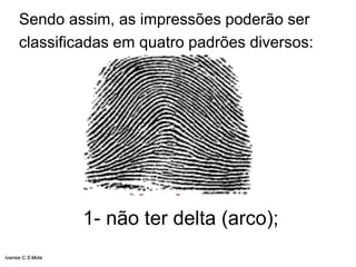 Sendo assim, as impressões poderão ser
classificadas em quatro padrões diversos:
1- não ter delta (arco);
Ivanise C.S.Mota
 