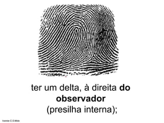 ter um delta, à direita do
observador
(presilha interna);
Ivanise C.S.Mota
 