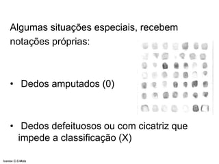 Algumas situações especiais, recebem
notações próprias:
• Dedos amputados (0)
• Dedos defeituosos ou com cicatriz que
impede a classificação (X)
Ivanise C.S.Mota
 