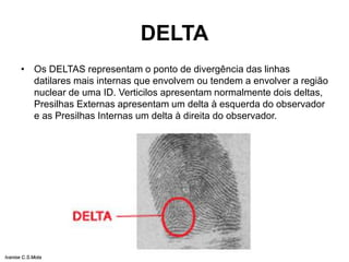 DELTA
• Os DELTAS representam o ponto de divergência das linhas
datilares mais internas que envolvem ou tendem a envolver a região
nuclear de uma ID. Verticilos apresentam normalmente dois deltas,
Presilhas Externas apresentam um delta à esquerda do observador
e as Presilhas Internas um delta à direita do observador.
Ivanise C.S.Mota
 