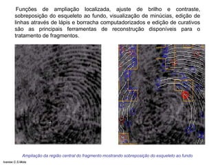 Funções de ampliação localizada, ajuste de brilho e contraste,
sobreposição do esqueleto ao fundo, visualização de minúcias, edição de
linhas através de lápis e borracha computadorizados e edição de curativos
são as principais ferramentas de reconstrução disponíveis para o
tratamento de fragmentos.
Ampliação da região central do fragmento mostrando sobreposição do esqueleto ao fundo
Ivanise C.S.Mota
 