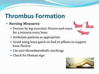 Thrombus Formation
 Nursing Measures:
    Prevent by leg exercises: flexion and extension of toes
     for 5 minutes every hour
    Ambulate patients as appropriate
    Avoid using knee gatch on bed or pillows to support
     knee flexion
    Use anti-thromboembolic stockings
    Check for Homan sign
 