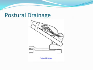 Postural Drainage




          Postural Drainage
               Postural Drainage
 