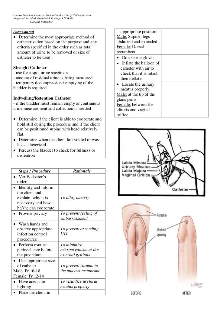 Urinary Catheterization Handouts