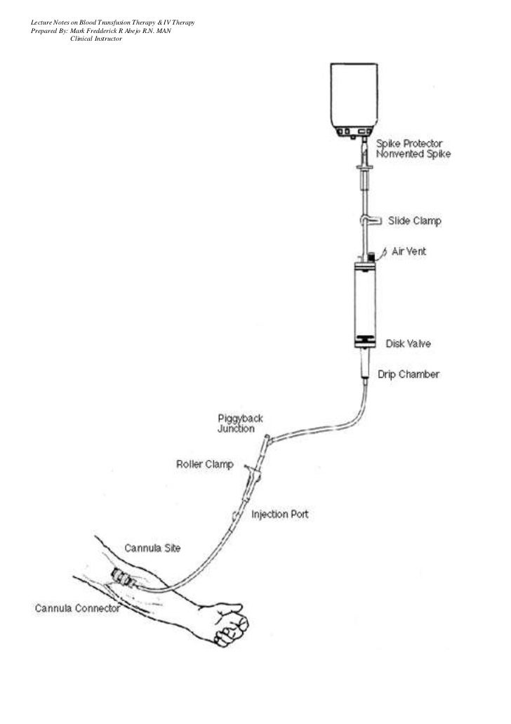 Blood TransfusionIV Therapy