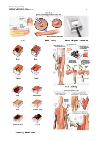 Medical and Surgical Nursing
Integumentary System Lecture Notes
Prepared by: Mark Fredderick R. Abejo RN,MAN                                       15




                    Nail                       Skin Testing   Wood’s Light Examination




                                                              Skin Grafting




           Secondary Skin Lesion
 