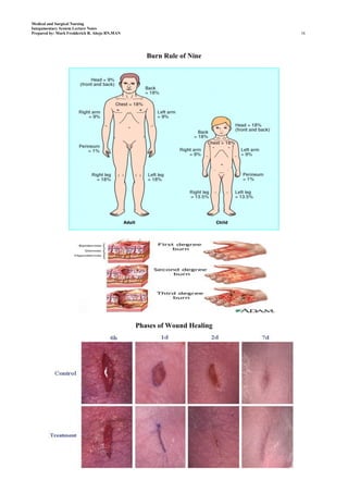 Medical and Surgical Nursing
Integumentary System Lecture Notes
Prepared by: Mark Fredderick R. Abejo RN,MAN                             16




                                                  Burn Rule of Nine




                                               Phases of Wound Healing
 