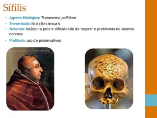 Sífilis
• Agente Etiológico: Treponema pallidum
• Transmissão: Relações sexuais
• Sintomas: lesões na pele e dificuldade de respirar e problemas no sistema
nervoso
• Profilaxia: uso de preservativos
 