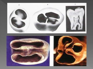Root Formation | PPTX