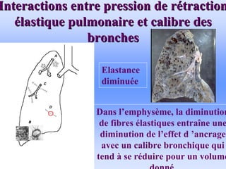 Interactions entre pression de r
Interactions entre pression de ré
étraction
traction
é
élastique pulmonaire et calibre des
lastique pulmonaire et calibre des
bronches
bronches
• .
Dans l’emphysème, la diminution
de fibres élastiques entraîne une
diminution de l’effet d ’ancrage
avec un calibre bronchique qui
tend à se réduire pour un volume
donné.
Elastance
diminuée
 
