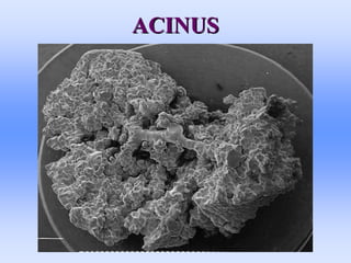 ACINUS
ACINUS
 