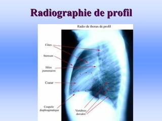 Radiographie de profil
Radiographie de profil
 