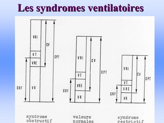 Les syndromes ventilatoires
Les syndromes ventilatoires
 