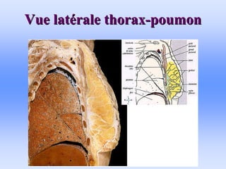 Vue lat
Vue laté
érale thorax
rale thorax-
-poumon
poumon
 