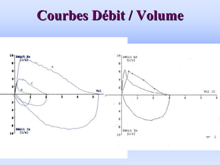 Courbes D
Courbes Dé
ébit / Volume
bit / Volume
 