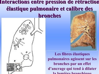 Interactions entre pression de r
Interactions entre pression de ré
étraction
traction
é
élastique pulmonaire et calibre des
lastique pulmonaire et calibre des
bronches
bronches
• .
Les fibres élastiques
pulmonaires agissent sur les
bronches par un effet
d’ancrage qui tend à dilater
la lumière bronchique
 