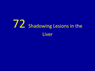 72 Shadowing Lesions in the
Liver
 