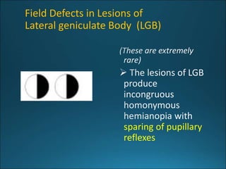 734_Visual_Pathway_lesions.pptx