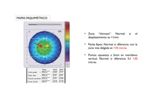 Normal Pachy 739583662-Queratocono clasificacion y estadios topográficos | PPTX