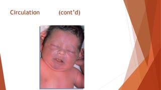 Circulation (cont’d)
 