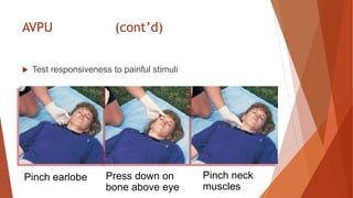 AVPU (cont’d)
 Test responsiveness to painful stimuli
Pinch earlobe Press down on
bone above eye
Pinch neck
muscles
 