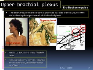 Upper brachial plexus
 The lesion produced is similar to that produced by a stab or bullet wound in the
neck affecting the superior trunk of the brachial plexus
Erb-Duchenne palsy
Neck wound
Superior trunk
• Affects C5 & C6 roots or the superior
trunk
• suprascapular nerve, nerve to subclavius,
musculocutaneous, and axillary nerves
are affected
4/6/2020 31Dr.Ravi
 
