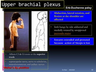 Upper brachial plexus Erb-Duchenne palsy
• Affects C5 & C6 roots or the superior
trunk
• suprascapular nerve, nerve to subclavius,
musculocutaneous, and axillary nerves
are affected
• Abduction, lateral rotation, and
flexion at the shoulder are
affected
• limb hangs by side adducted and
medially rotated by unopposed
pectoralis major
• forearm extended and pronated
because action of biceps is lost
Waiter’s tip position
4/6/2020 32Dr.Ravi
 