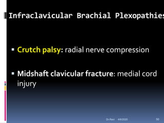 Infraclavicular Brachial Plexopathies
 Crutch palsy: radial nerve compression
 Midshaft clavicular fracture: medial cord
injury
4/6/2020 50Dr.Ravi
 