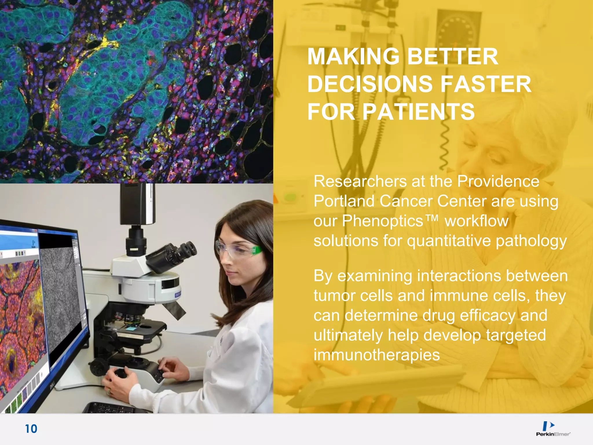 10
MAKING BETTER
DECISIONS FASTER
FOR PATIENTS
Researchers at the Providence
Portland Cancer Center are using
our Phenoptics™ workflow
solutions for quantitative pathology
By examining interactions between
tumor cells and immune cells, they
can determine drug efficacy and
ultimately help develop targeted
immunotherapies
10
 