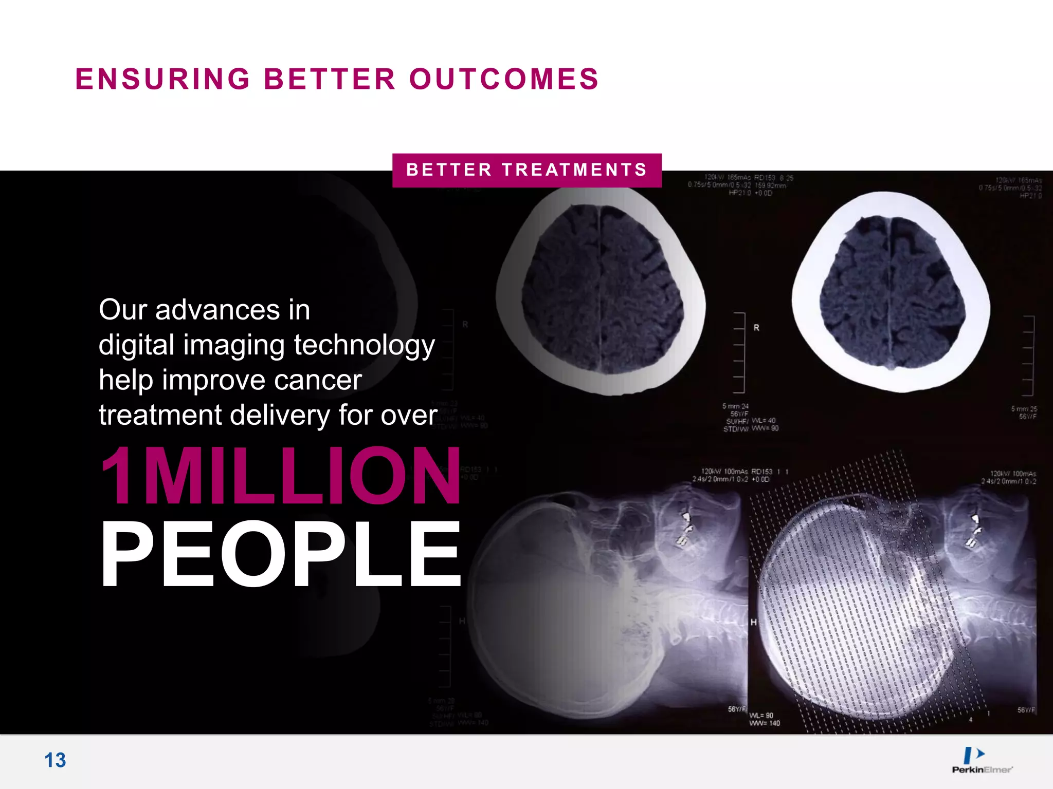 13
1MILLION
Our advances in
digital imaging technology
help improve cancer
treatment delivery for over
PEOPLE
B E T T E R T R E AT M E N T S
ENSURING BETTER OUTCOMES
 