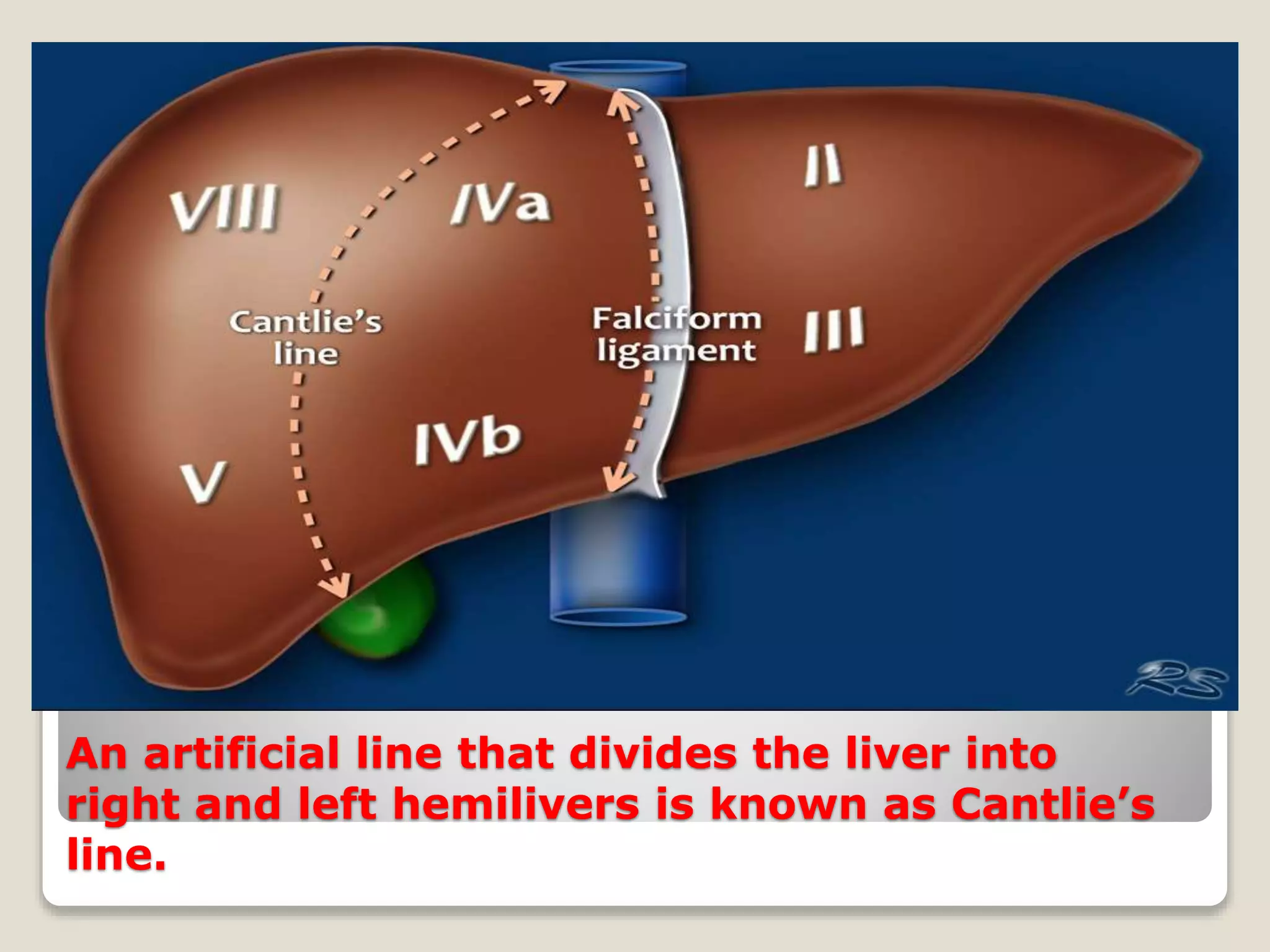 An artificial line that divides the liver into
right and left hemilivers is known as Cantlie’s
line.
 